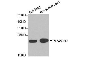 Western blot analysis of extracts of rat lung and rat spinal cord cell lines, using PLA2G2D antibody. (PLA2G2D antibody)