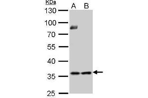 WB Image Thymidylate synthetase antibody detects TYMS protein by Western blot analysis. (TYMS antibody)