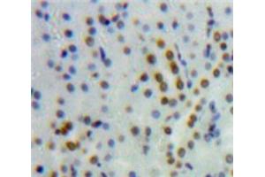 Used in DAB staining on fromalin fixed paraffin-embedded Kidney tissue (HNF4A antibody  (AA 131-330))