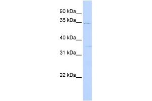 WB Suggested Anti-RORA Antibody Titration:  0. (RORA antibody  (N-Term))