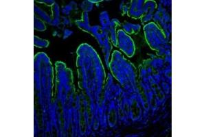 IF analysis of Villin using anti-Villin antibody (ABIN3042343). (Villin 1 antibody  (C-Term))
