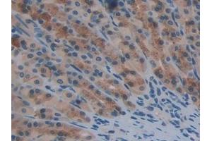 Detection of TXNRD1 in Rat Stomach Tissue using Polyclonal Antibody to Thioredoxin Reductase 1 (TXNRD1) (TXNRD1 antibody  (AA 208-433))