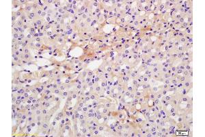 Formalin-fixed and paraffin embedded rat kidney labeled with Anti-CXCR7/RDC1 Polyclonal Antibody, Unconjugated (ABIN1387536) at 1:200 followed by conjugation to the secondary antibody and DAB staining. (CXCR7 antibody  (AA 151-250))