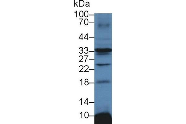 ATP1B3 抗体  (AA 61-277)