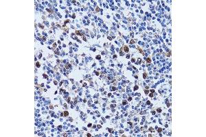 Immunohistochemistry of paraffin-embedded human tonsil using UHRF1 antibody. (UHRF1 antibody  (AA 1-260))