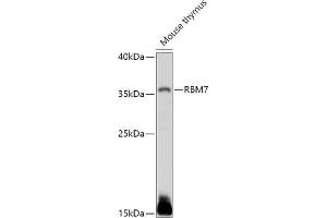 Western blot analysis of extracts of Mouse thymus, using RBM7 antibody (ABIN7270088) at 1:1000 dilution. (RBM7 antibody  (AA 1-266))