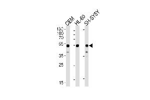 Western blot analysis of lysates from CEM, HL-60, SH-SY5Y cell lines (from left to right) using GATA3 Antibody (Center) (ABIN1944795 and ABIN2838499). (GATA3 antibody  (AA 1-444))