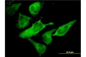 Immunofluorescence of monoclonal antibody to EIF2S1 on HeLa cell. (EIF2S1 antibody  (AA 1-315))