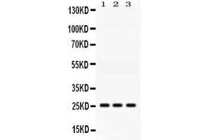 Western blot analysis of AK2 expression in rat liver extract ( Lane 1), mouse kidney extract ( Lane 2) and HELA whole cell lysates ( Lane 3).