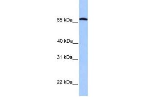 Calicin antibody used at 1 ug/ml to detect target protein. (Calicin antibody  (C-Term))