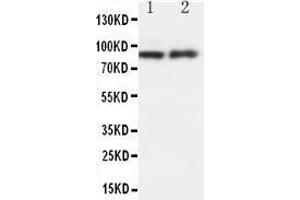 Anti-GRP94 antibody, Western blotting Lane 1: RAJI Cell Lysate Lane 2: MCF-7 Cell Lysate (GRP94 antibody  (Middle Region))