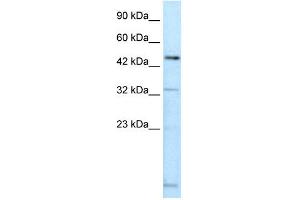 WB Suggested Anti-DMRTA2 Antibody Titration: 0.