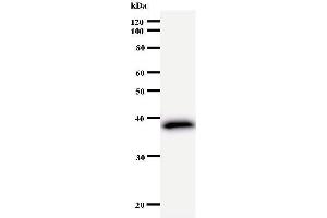 Western Blotting (WB) image for anti-FER Tyrosine Kinase (FER) antibody (ABIN933005) (FER antibody)