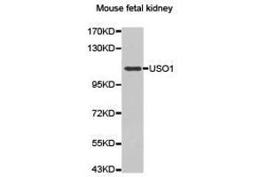 Western Blotting (WB) image for anti-USO1 Homolog, Vesicle Docking Protein (USO1) antibody (ABIN1875291)