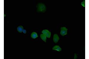 Immunofluorescence staining of MCF-7 cells with ABIN7139704 at 1:50, counter-stained with DAPI. (PSMD6 antibody  (Regulatory Subunit 6))