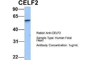 Host: Rabbit Target Name: CELF2 Sample Type: Human Fetal Heart Antibody Dilution: 1. (CELF2 antibody  (N-Term))