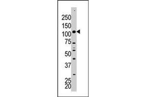 The HK2 polyclonal antibody  is used in Western blot to detect HK2 in A-375 cell lysate. (Hexokinase 2 antibody  (Internal Region))