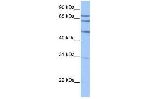 TSKS antibody used at 1 ug/ml to detect target protein. (TSKS antibody  (N-Term))