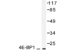 Image no. 2 for anti-Eukaryotic Translation Initiation Factor 4E Binding Protein 1 (EIF4EBP1) antibody (ABIN271863) (eIF4EBP1 antibody)
