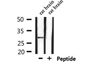 Western blot analysis of extracts from rat brain, using OR6C75 Antibody. (OR6C75 antibody)