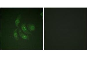 Immunofluorescence analysis of HepG2 cells, using CaMK4 (Ab-196/200) Antibody. (CAMK4 antibody  (AA 166-215))