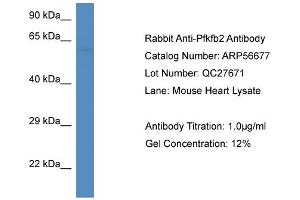 Western Blotting (WB) image for anti-6-phosphofructo-2-Kinase/fructose-2,6-Biphosphatase 2 (PFKFB2) (C-Term) antibody (ABIN2786833)