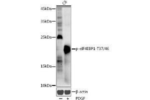 Western blot analysis of extracts of C6 cells, using Phospho-eIF4EBP1-T37/46 antibody (ABIN3019469, ABIN3019470, ABIN3019471 and ABIN6225387) at 1:1000 dilution. (eIF4EBP1 antibody  (pThr37, pThr46))