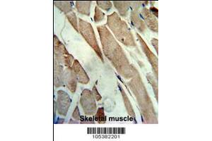 Formalin-fixed and paraffin-embedded human skeletal muscle reacted with the primary antibody, which was peroxidase-conjugated to the secondary antibody, followed by AEC staining. (CKM antibody  (C-Term))