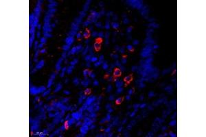 Immunofluorescence of paraffin embedded mouse appendix using MS4A2 (ABIN7074594) at dilution of 1: 400 (550x lens) (MS4A2 antibody)
