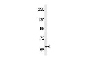 TEC Antibody  (ABIN392111 and ABIN2841862) western blot analysis in NCI- cell line lysates (35 μg/lane). (NR4A3 antibody  (AA 175-205))