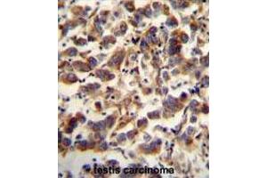 Immunohistochemistry (Paraffin-embedded Sections) (IHC (p)) image for anti-Transcription Factor A, Mitochondrial (TFAM) (AA 223-254), (C-Term) antibody (ABIN955168)