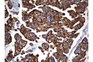 Image no. 1 for anti-BCL2/adenovirus E1B 19kDa Interacting Protein 1 (BNIP1) (AA 1-199) antibody (ABIN1490605) (BNIP1 antibody  (AA 1-199))