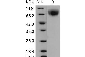 Western Blotting (WB) image for Lysosomal-Associated Membrane Protein 2 (LAMP2) protein (His tag) (ABIN7320146) (LAMP2 Protein (His tag))