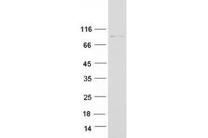 Validation with Western Blot (RAP1GAP Protein (Transcript Variant 3) (Myc-DYKDDDDK Tag))