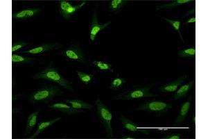 Immunofluorescence of purified MaxPab antibody to CUGBP1 on HeLa cell. (CELF1 antibody  (AA 1-483))
