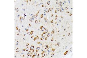 Immunohistochemistry of paraffin-embedded mouse brain using RPS20 Rabbit mAb (ABIN7270017) at dilution of 1:100 (40x lens).