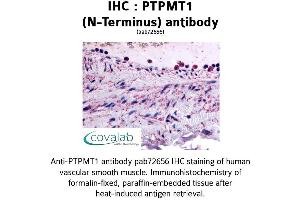 Image no. 1 for anti-Protein Tyrosine Phosphatase, Mitochondrial 1 (PTPMT1) (N-Term) antibody (ABIN1738592) (PTPMT1 antibody  (N-Term))