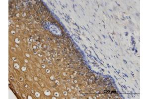 Immunostaining (ISt) image for anti-Coronin, Actin Binding Protein, 1C (CORO1C) (AA 375-473) antibody (ABIN525302)