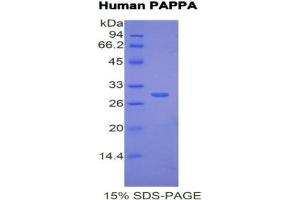 SDS-PAGE analysis of Human PAPPA Protein.