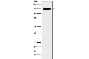 Western blot analysis of p150 CAF1 expression in K562 cell lysate. (Recombinant CHAF1A antibody)