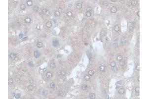 IHC-P analysis of Rat Liver Tissue, with DAB staining. (ORM1 antibody  (AA 19-186))