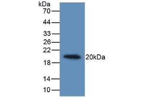 Detection of Recombinant IL19, Human using Monoclonal Antibody to Interleukin 19 (IL19) (IL-19 antibody  (AA 25-177))