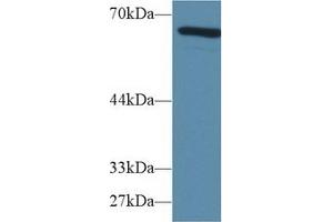 Detection of AFP in Mouse Lung lysate using Polyclonal Antibody to Alpha-Fetoprotein (AFP) (alpha Fetoprotein antibody  (AA 399-605))