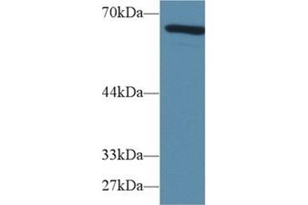 alpha Fetoprotein antibody  (AA 399-605)