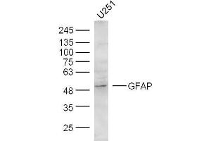 U251 Cells lysates probed with GFAP Polyclonal Antibody, unconjugated  at 1:300 overnight at 4°C followed by a conjugated secondary antibody at 1:10000 for 60 minutes at 37°C. (GFAP antibody  (AA 51-150))