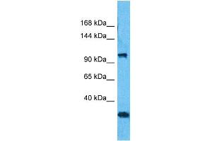 Host:  Rabbit  Target Name:  MORC3  Sample Type:  293T Whole Cell lysates  Antibody Dilution:  1.