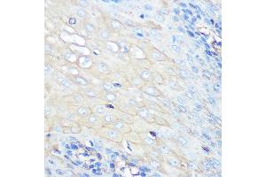 Immunohistochemistry of paraffin-embedded human esophageal using CCR7 Rabbit mAb (ABIN7266309) at dilution of 1:100 (40x lens). (CCR7 antibody)