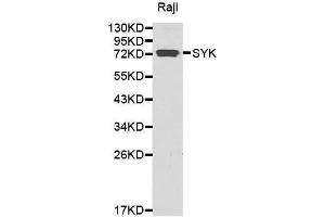 Western blot analysis of extracts of Raji cell lines, using SYK antibody. (SYK antibody)