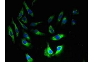 Immunofluorescent analysis of Hela cells using ABIN7144373 at dilution of 1:100 and Alexa Fluor 488-congugated AffiniPure Goat Anti-Rabbit IgG(H+L) (AP2S1 antibody  (AA 1-142))