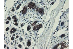 Immunohistochemical staining of paraffin-embedded Human breast tissue using anti-DPH2 mouse monoclonal antibody. (DPH2 antibody)